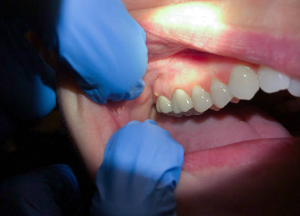 Best Emergency Cosmetic Dentistry in Grace, ID